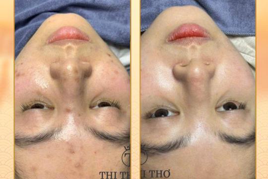 Thi Thi Tho Phan Rang Spa