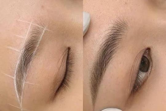 프엉마이 닌투언 뷰티 클리닉